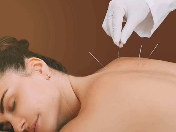 Acupuntura Integrativa • Pós-Graduação • Lato Sensu